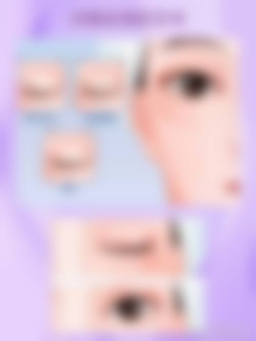 四、浙江杭州瑞丽整形(玉古路店)特色项目