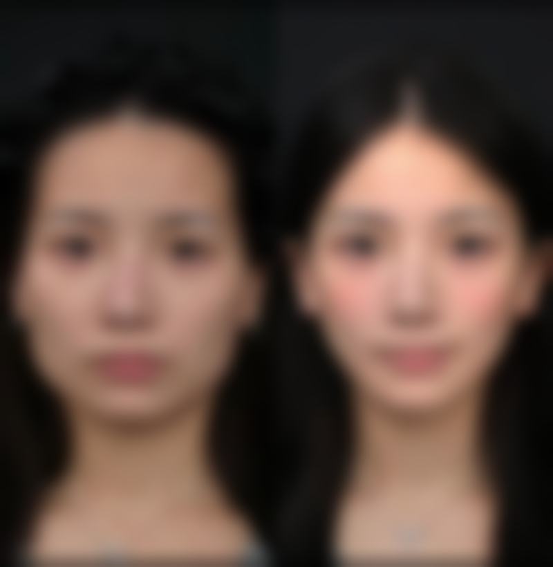 九、TCB松江真实的患者评价