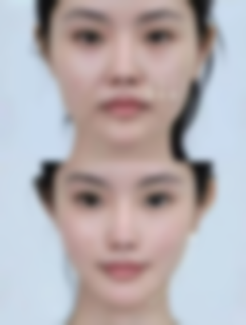 六、怎么快速有效消除眼袋之食疗内调法