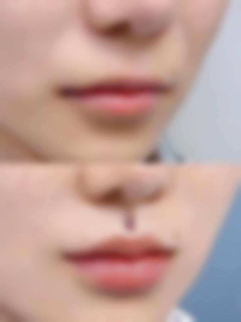 八、韩国安瑟琳医院真实的患者评价