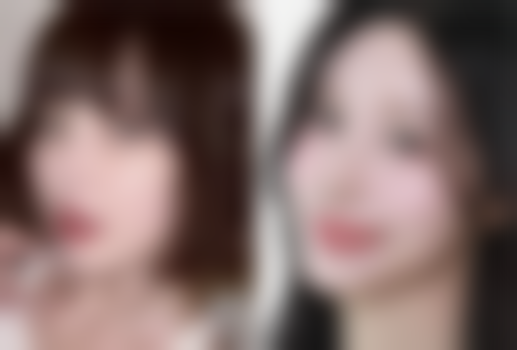 四、促进开眼角割双眼皮修复的小窍门