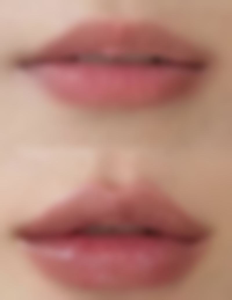 七、怎么快速有效消除眼袋之按摩法