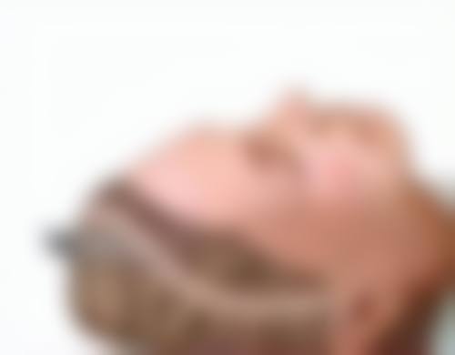 疤痕体质能做激光脱毛吗？详细风险评估与替代方案助你安全脱毛 