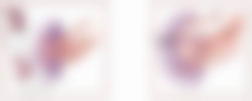 做完双眼皮拆线后眼皮有褶皱怎么办？分阶段解决方案与注意事项来帮您 