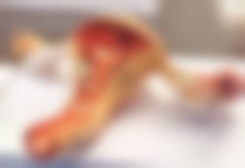 一、怎么消除眼袋简单的——了解眼袋形成原因