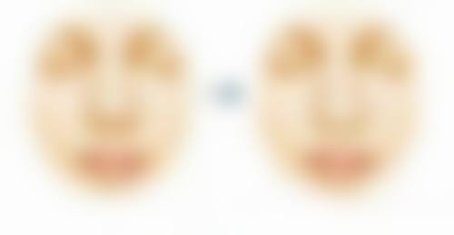 二、首尔丽温REON整形外科医院怎么样？