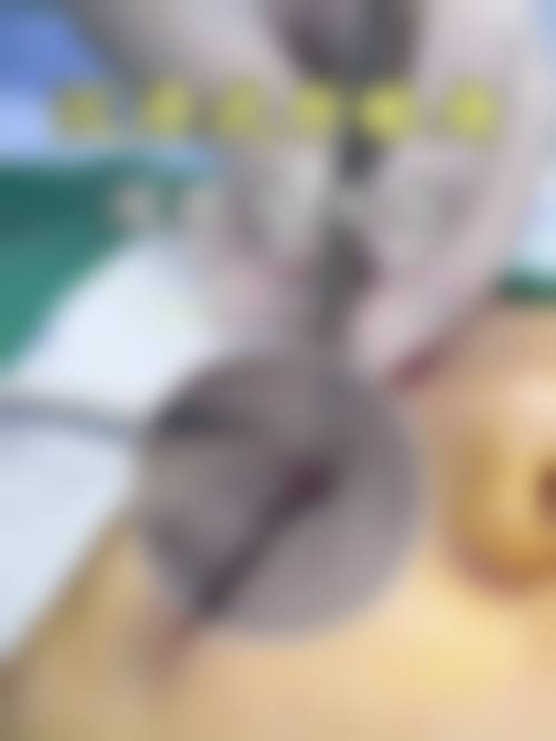 七、长沙恩喜整形美容医院预约方式