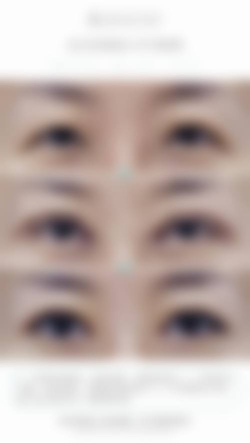 二、长沙恩喜整形美容医院怎么样？