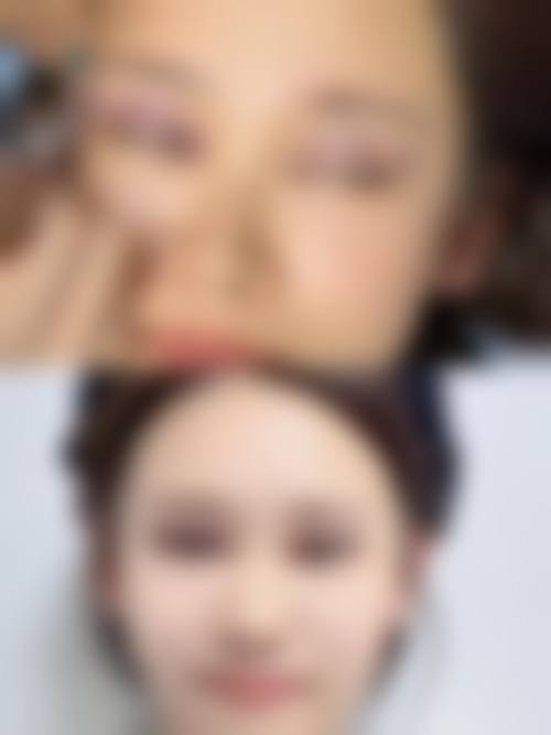 八、任丘卓芝丽整形医院真实的患者评价