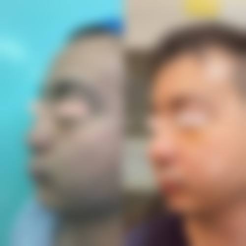 四、东莞韩秀医疗美容门诊部特色项目