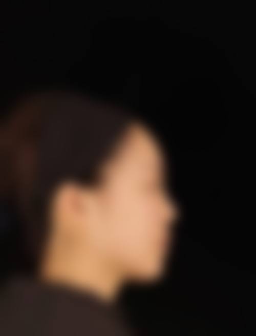 四、长沙恩喜整形美容医院特色项目