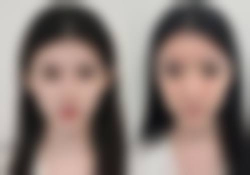 二、景德镇艾薇医疗美容门诊部怎么样？