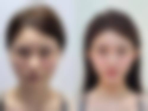 三、通化梅河口市百颜整形美容医院诊疗项目有哪些？