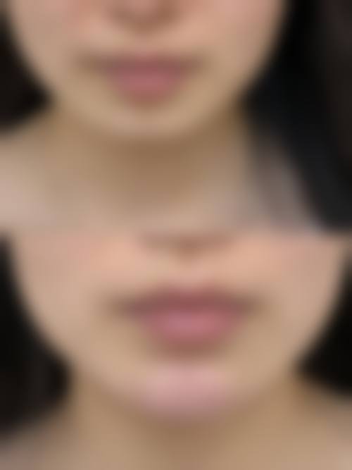 四、台州颜星医疗美容门诊部特色项目