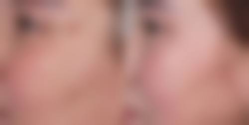 二、邵阳宸美医疗美容医院怎么样？