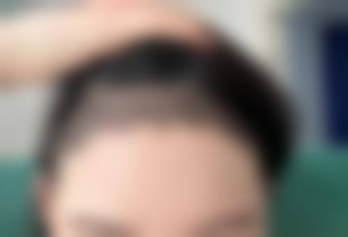 七、南昌艺之美整形医院预约方式