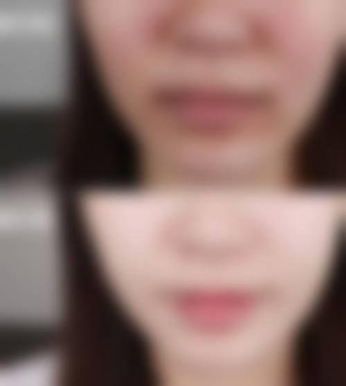 七、东莞韩秀医疗美容门诊部预约方式