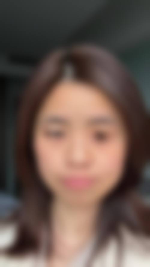 八、东莞韩秀医疗美容门诊部真实的患者评价