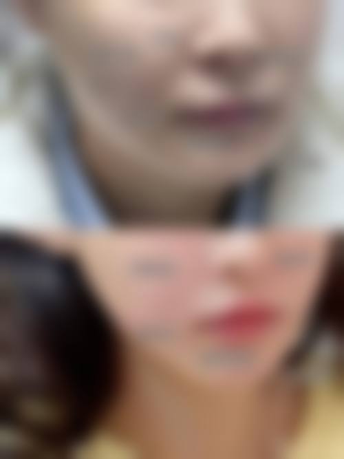 二、东莞韩秀医疗美容门诊部怎么样？