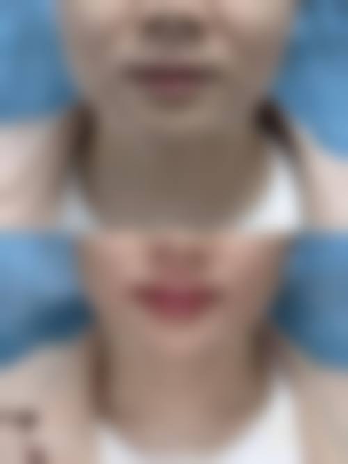 六、惠州瑞芙臣医学整形美容医院价格表