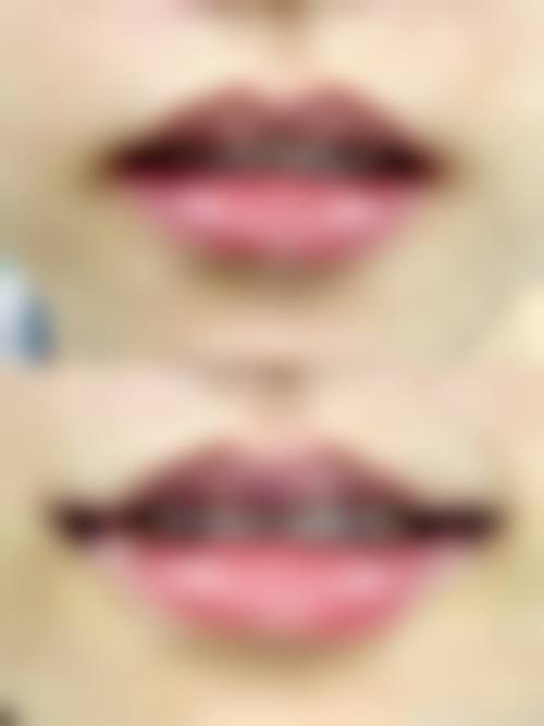 八、惠州瑞芙臣医学整形美容医院预约方式