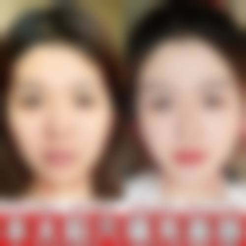 二、任丘卓芝丽整形医院怎么样?