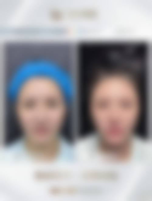 七、任丘卓芝丽整形医院预约方式