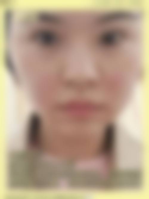 九、杭州临安芘丽芙医疗整形美容医院真实的患者评价