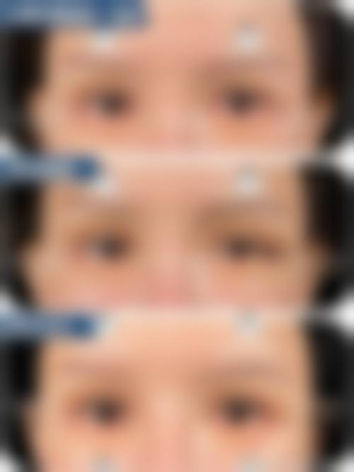 五、台安晨美整形医院价格表