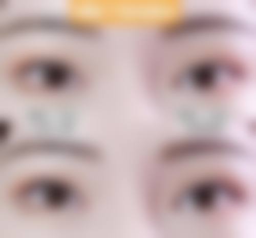 八、台安晨美整形医院真实的患者评价