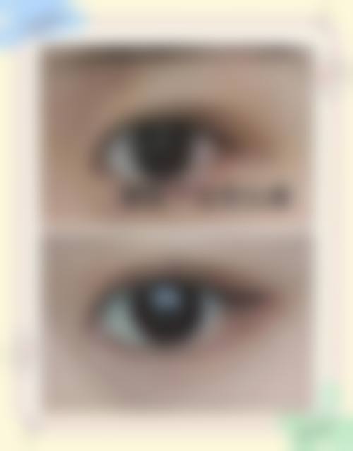 七、台安晨美整形医院预约方式