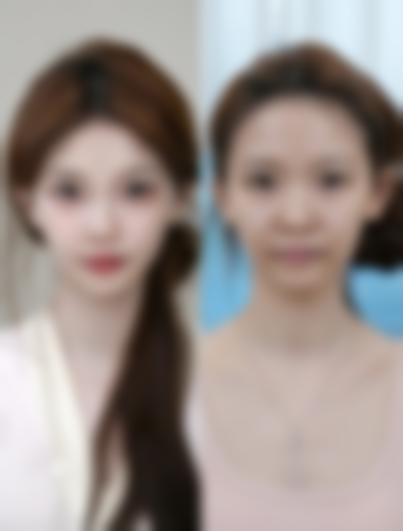 二、芦荟对不同类型疤痕的适用性