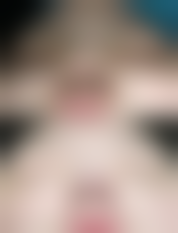 四、邵阳宸美医疗美容医院特色项目