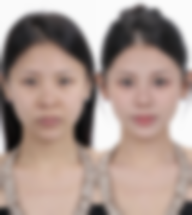 四、理性看待疤痕修复