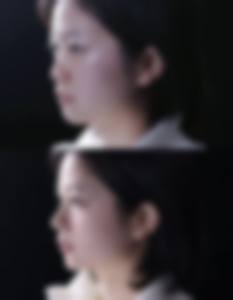 二、怎么消除眼袋简单的——日常护理方法