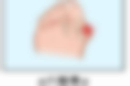 割完双眼皮生理盐水要用多久才好？时间选择关乎恢复效果，看完你就懂了 