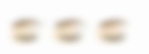 双眼皮深浅是什么决定的？遗传、眼部结构、手术方式等多因素揭秘！ 