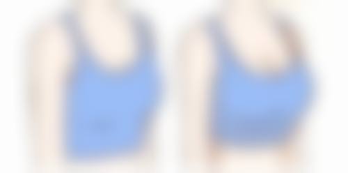 五、瘦脸针注射的其他注意事项