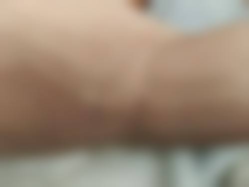 八、十堰楚美熙整形医院真实的患者评价