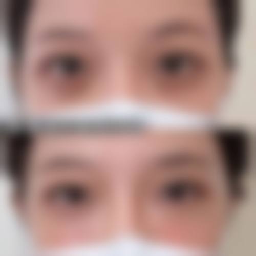 二、深圳常安润禾整形医院怎么样？