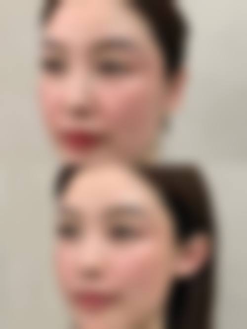 六、深圳常安润禾整形医院价格表