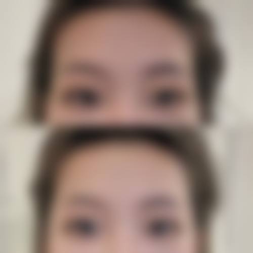 八、佛山和本医疗美容门诊部真实的患者评价