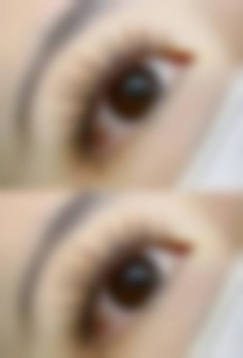 五、南昌瑞丽诗植发医院价格表