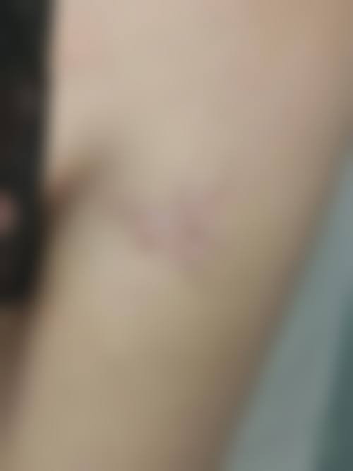 二、温州澳兰阁医疗美容诊所怎么样？