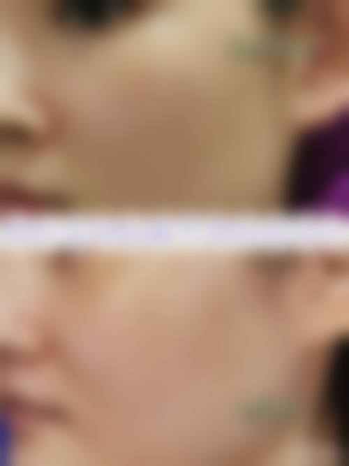 五、北京466医院整形美容科价格表