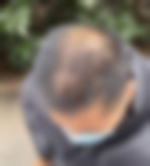 三、南昌瑞丽诗植发医院诊疗项目有哪些？