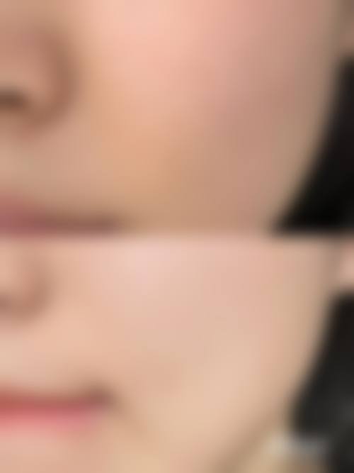 四、普洱研美医疗美容诊所特色项目