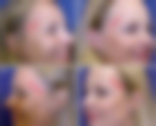 七、武汉铂晟整形医院预约方式