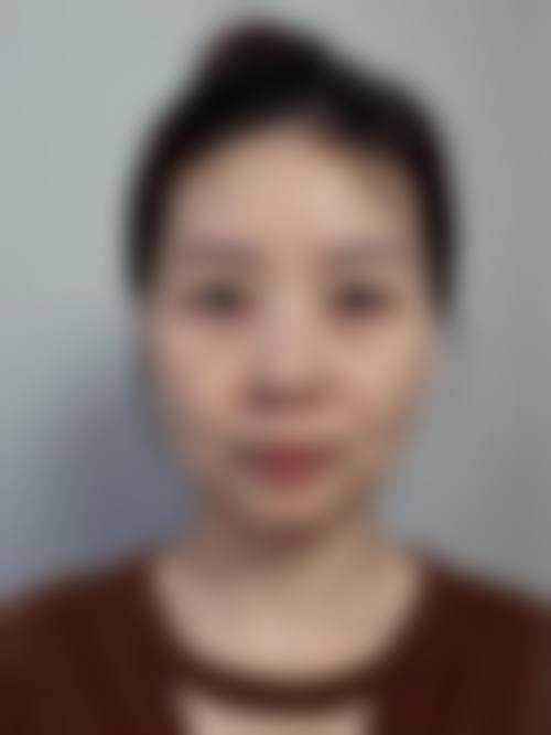 五、普洱研美医疗美容诊所价格表