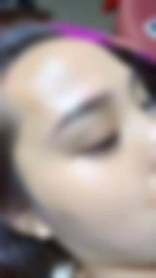 四、深圳常安润禾整形医院特色项目